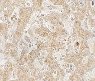 Immunohistochemistry (Formalin/PFA-fixed paraffin-embedded sections) - Anti-CCR7/CD197 antibody (AB191575)