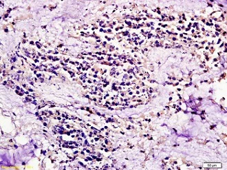 Immunohistochemistry (Formalin/PFA-fixed paraffin-embedded sections) - Anti-CCR7 antibody (AB217181)