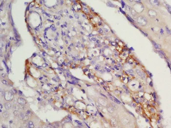 Immunohistochemistry (Formalin/PFA-fixed paraffin-embedded sections) - Anti-CCR7 antibody (AB217181)
