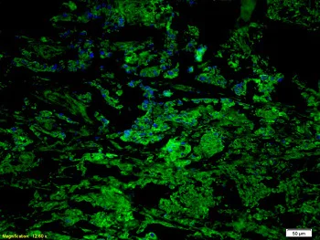 Immunohistochemistry (Formalin/PFA-fixed paraffin-embedded sections) - Anti-CCR7 antibody (AB217181)