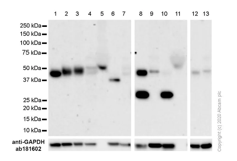 Western blot - Anti-CCR7 antibody [E75] - BSA and Azide free (AB247223)