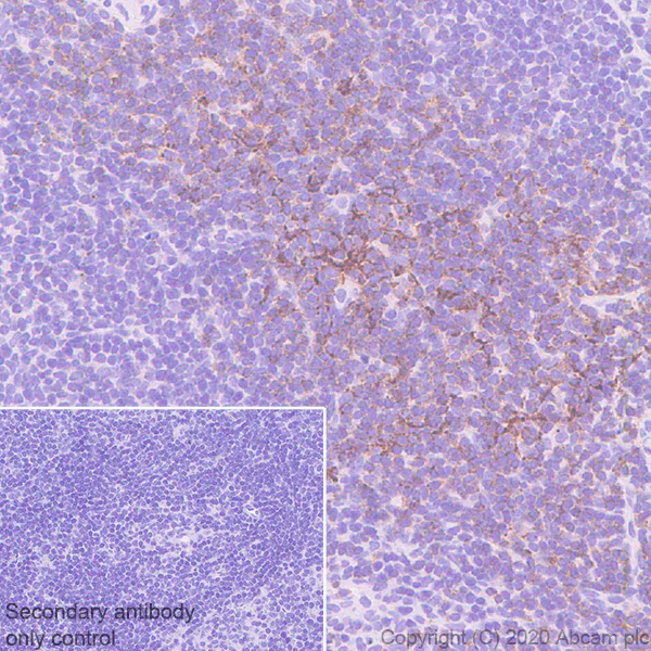 Immunohistochemistry (Formalin/PFA-fixed paraffin-embedded sections) - Anti-CCR7 antibody [EPR23192-57] - BSA and Azide free (AB272938)
