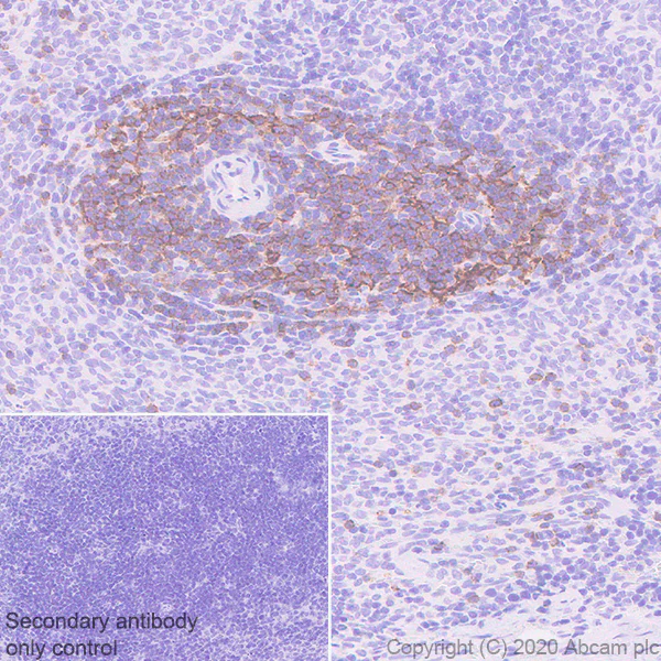 Immunohistochemistry (Formalin/PFA-fixed paraffin-embedded sections) - Anti-CCR7 antibody [EPR23192-57] - BSA and Azide free (AB272938)