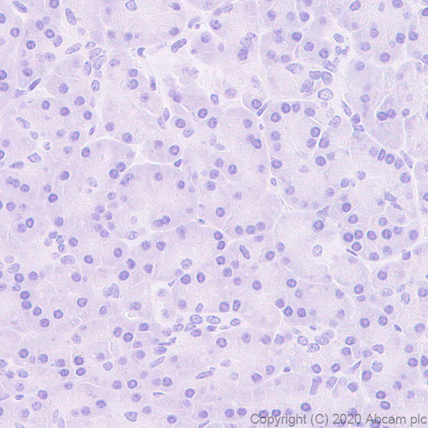Immunohistochemistry (Formalin/PFA-fixed paraffin-embedded sections) - Anti-CCR7 antibody [EPR23192-57] - BSA and Azide free (AB272938)