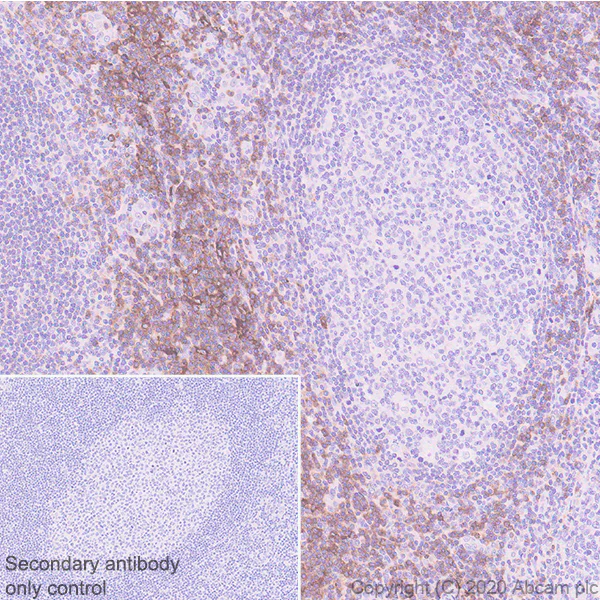 Immunohistochemistry (Formalin/PFA-fixed paraffin-embedded sections) - Anti-CCR7 antibody [EPR23192-57] - BSA and Azide free (AB272938)