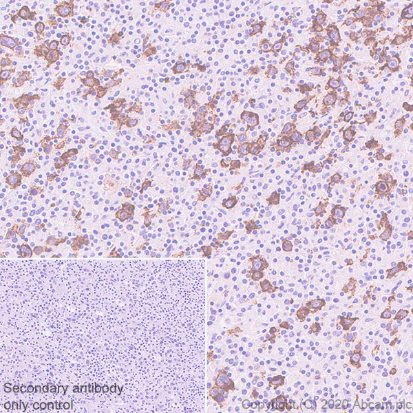 Immunohistochemistry (Formalin/PFA-fixed paraffin-embedded sections) - Anti-CCR7 antibody [EPR23192-57] - BSA and Azide free (AB272938)