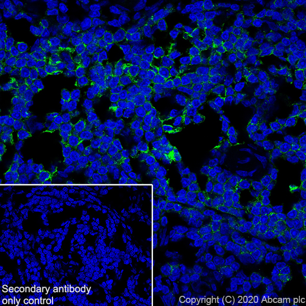 Anti-CCR7 antibody [EPR23192-57] - BSA and Azide free