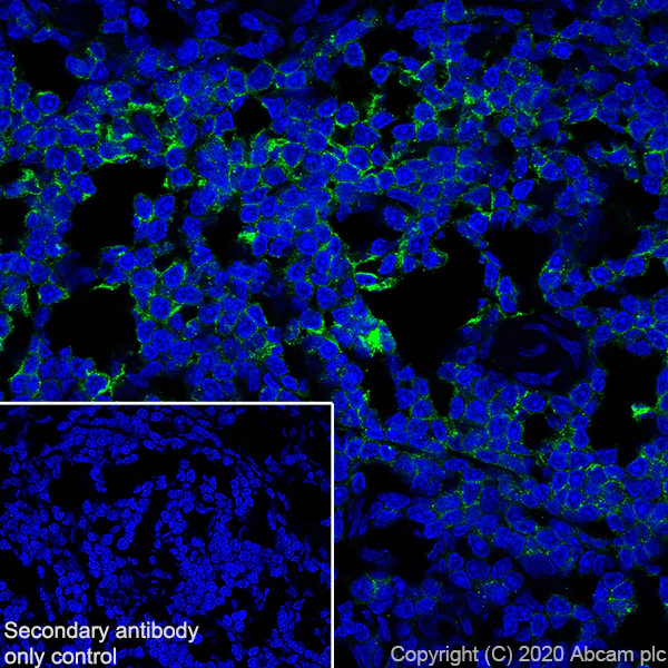 Immunohistochemistry (Frozen sections) - Anti-CCR7 antibody [EPR23192-57] - BSA and Azide free (AB272938)