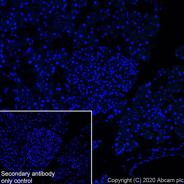 Immunohistochemistry (Frozen sections) - Anti-CCR7 antibody [EPR23192-57] - BSA and Azide free (AB272938)