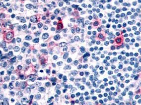 Immunohistochemistry (Formalin/PFA-fixed paraffin-embedded sections) - Anti-CCR8 antibody (AB140796)