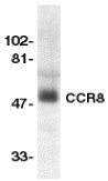 Western blot - Anti-CCR8 antibody (AB8019)
