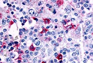 Immunohistochemistry (Formalin/PFA-fixed paraffin-embedded sections) - Anti-CCR8 antibody - C-terminal (AB140804)