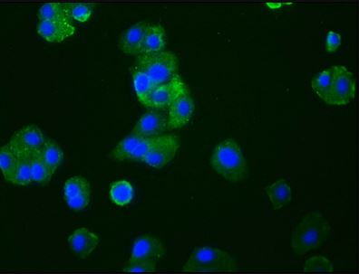 Immunocytochemistry/ Immunofluorescence - Anti-CCR9 antibody [4G2] (AB288375), expandable thumbnail