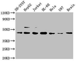 Western blot - Anti-CCR9 antibody [4G2] (AB288375), expandable thumbnail