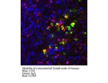 Immunocytochemistry/ Immunofluorescence - Anti-CCR9 antibody [7E7] (AB52590)