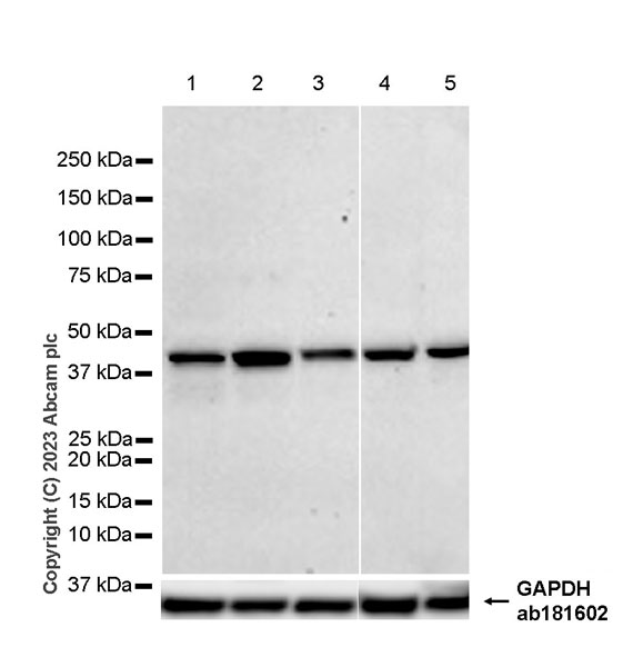 Western blot - Anti-CCR9 antibody [EPR26524-22] - BSA and Azide free (AB308446), expandable thumbnail