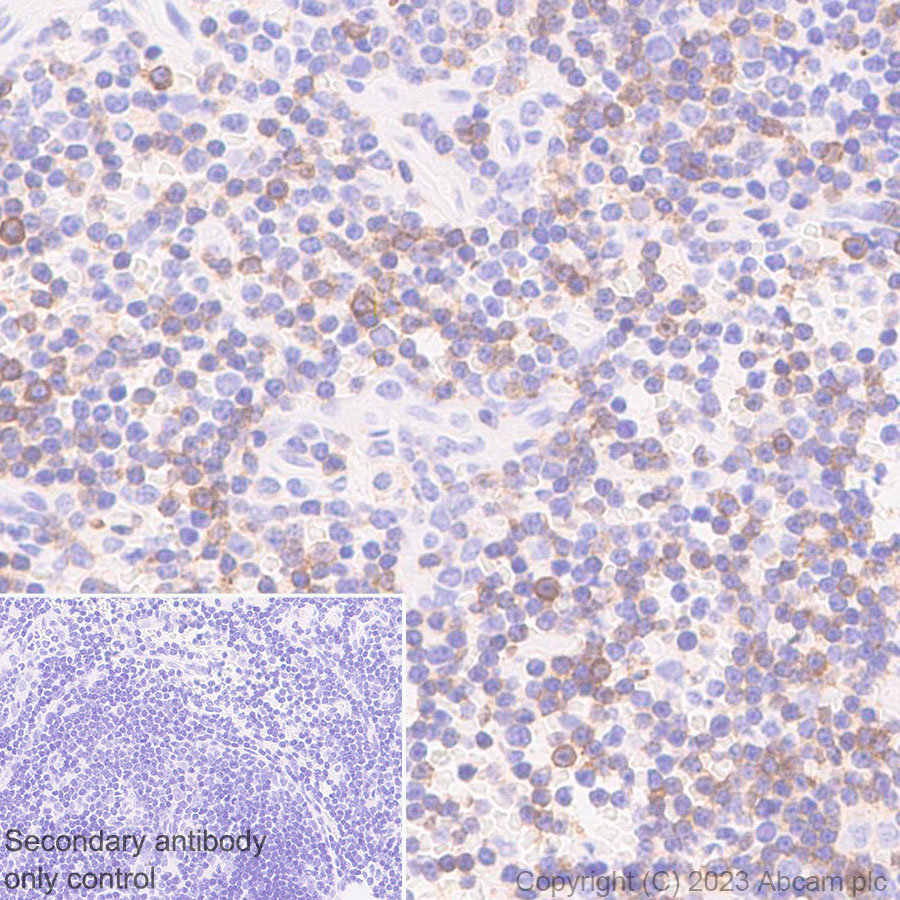 Immunohistochemistry (Formalin/PFA-fixed paraffin-embedded sections) - Anti-CCR9 antibody [EPR26524-59] (ab313773), expandable thumbnail