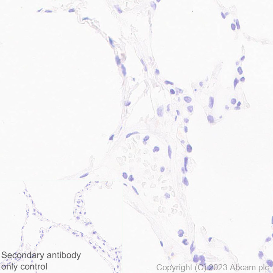 Immunohistochemistry (Formalin/PFA-fixed paraffin-embedded sections) - Anti-CCR9 antibody [EPR26524-59] (ab313773), expandable thumbnail