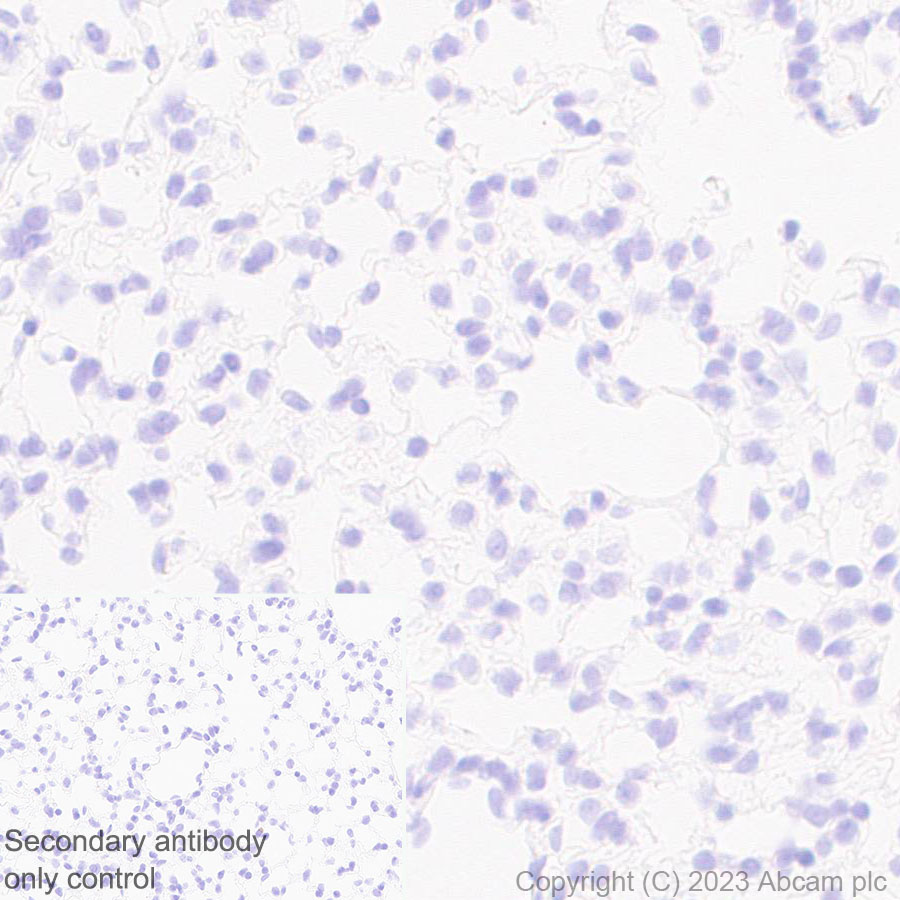 Immunohistochemistry (Formalin/PFA-fixed paraffin-embedded sections) - Anti-CCR9 antibody [EPR26524-59] (ab313773), expandable thumbnail