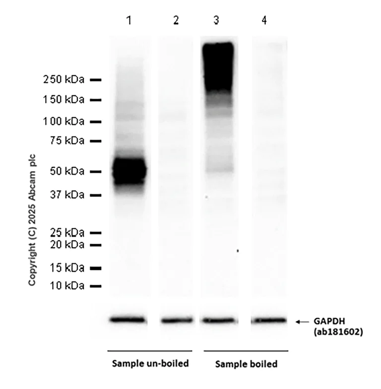 Western blot - Anti-CCR9 antibody [EPR26524-59] (AB313773)