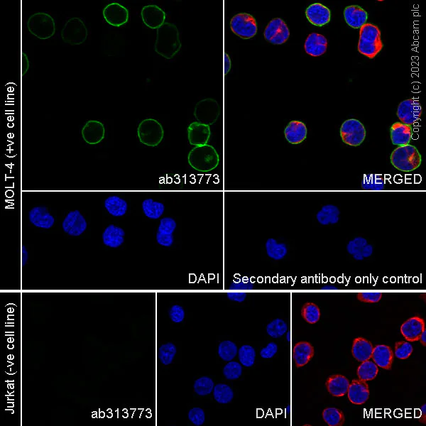 Immunocytochemistry/ Immunofluorescence - Anti-CCR9 antibody [EPR26524-59] - BSA and Azide free (AB313774)