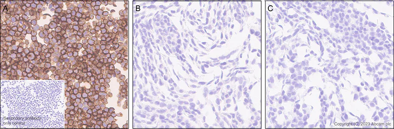 Immunohistochemistry (Formalin/PFA-fixed paraffin-embedded sections) - Anti-CCR9 antibody [EPR26524-59] - BSA and Azide free (AB313774)
