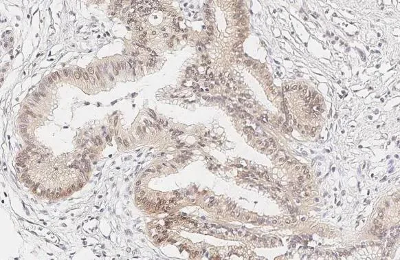 Immunohistochemistry (Formalin/PFA-fixed paraffin-embedded sections) - Anti-CCR9 antibody [HL3054] - BSA and Azide free (AB325844)
