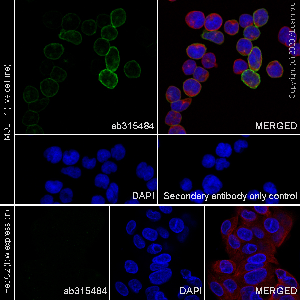 Immunocytochemistry/ Immunofluorescence - Anti-CCR9 antibody [RM2031] (ab315484), expandable thumbnail