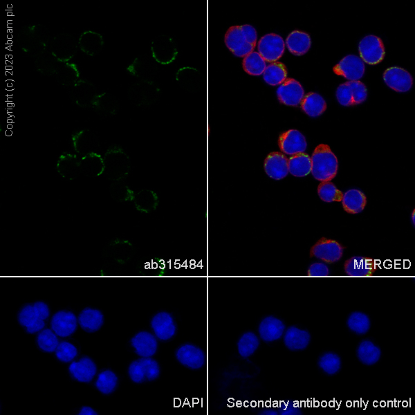 Immunocytochemistry/ Immunofluorescence - Anti-CCR9 antibody [RM2031] (ab315484), expandable thumbnail
