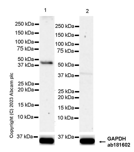 Western blot - Anti-CCR9 antibody [RM2031] (ab315484), expandable thumbnail