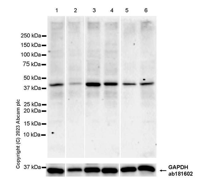 Western blot - Anti-CCR9 antibody [RM2031] (AB315484), expandable thumbnail