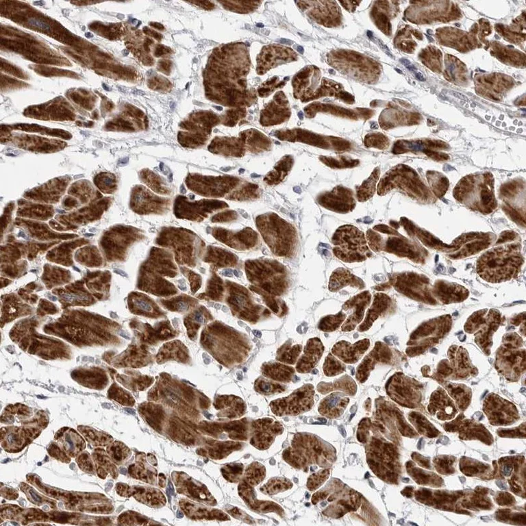 Immunohistochemistry (Formalin/PFA-fixed paraffin-embedded sections) - Anti-CCRK antibody (AB252986)