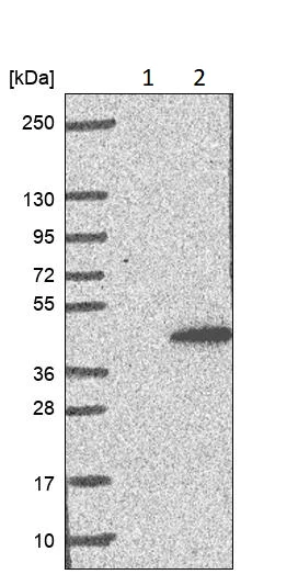 Western blot - Anti-CCRK antibody (AB252986)