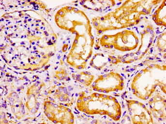 Immunohistochemistry (Formalin/PFA-fixed paraffin-embedded sections) - Anti-CCRL2 antibody (AB235002)