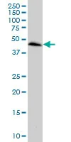 Western blot - Anti-CCRL2 antibody (AB88632)