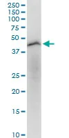 Western blot - Anti-CCRL2 antibody (AB88632)