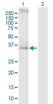 Western blot - Anti-CCRL2 antibody (AB88632)