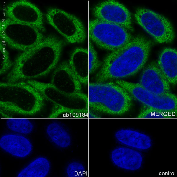 Immunocytochemistry/ Immunofluorescence - Anti-CCT2 antibody [EPR4083] (AB109184), expandable thumbnail