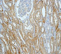 Immunohistochemistry (Formalin/PFA-fixed paraffin-embedded sections) - Anti-CCT2 antibody [EPR4083] (AB109184), expandable thumbnail