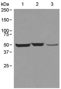 Western blot - Anti-CCT2 antibody [EPR4083] (AB109184), expandable thumbnail