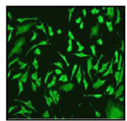 Immunocytochemistry/ Immunofluorescence - Anti-CCT2 antibody [EPR4084] (AB92746)