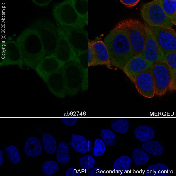 Immunocytochemistry/ Immunofluorescence - Anti-CCT2 antibody [EPR4084] (AB92746)