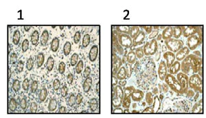 Immunohistochemistry (Formalin/PFA-fixed paraffin-embedded sections) - Anti-CCT2 antibody [EPR4084] (AB92746)