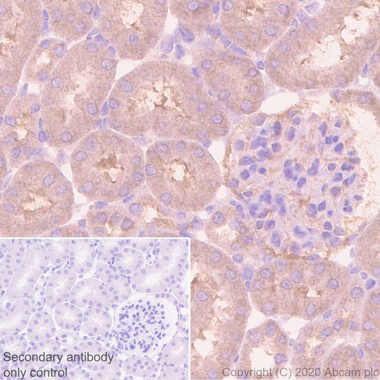 Immunohistochemistry (Formalin/PFA-fixed paraffin-embedded sections) - Anti-CCT2 antibody [EPR4084] (AB92746)