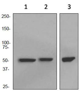 Western blot - Anti-CCT2 antibody [EPR4084] (AB92746)
