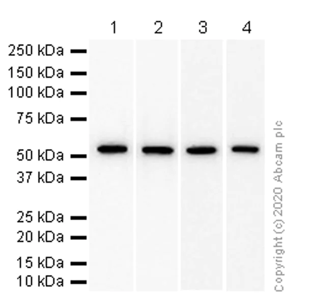 Western blot - Anti-CCT2 antibody [EPR4084] (AB92746)