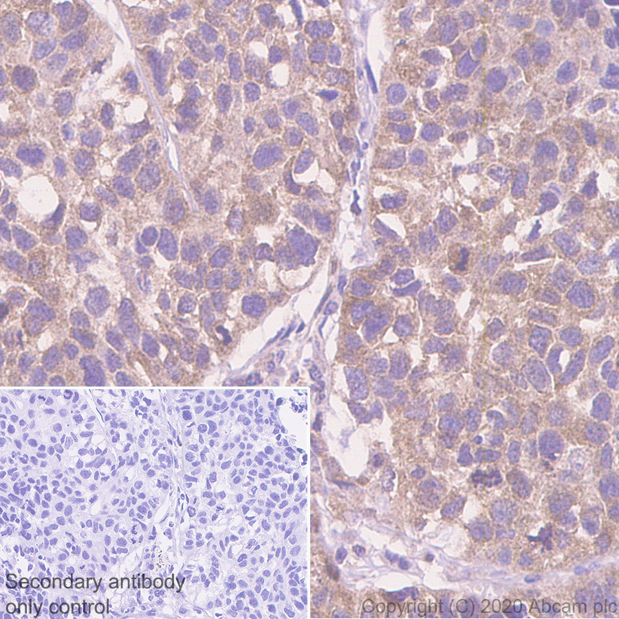 Immunohistochemistry (Formalin/PFA-fixed paraffin-embedded sections) - Anti-CCT2 antibody [EPR4084] - BSA and Azide free (AB247598), expandable thumbnail