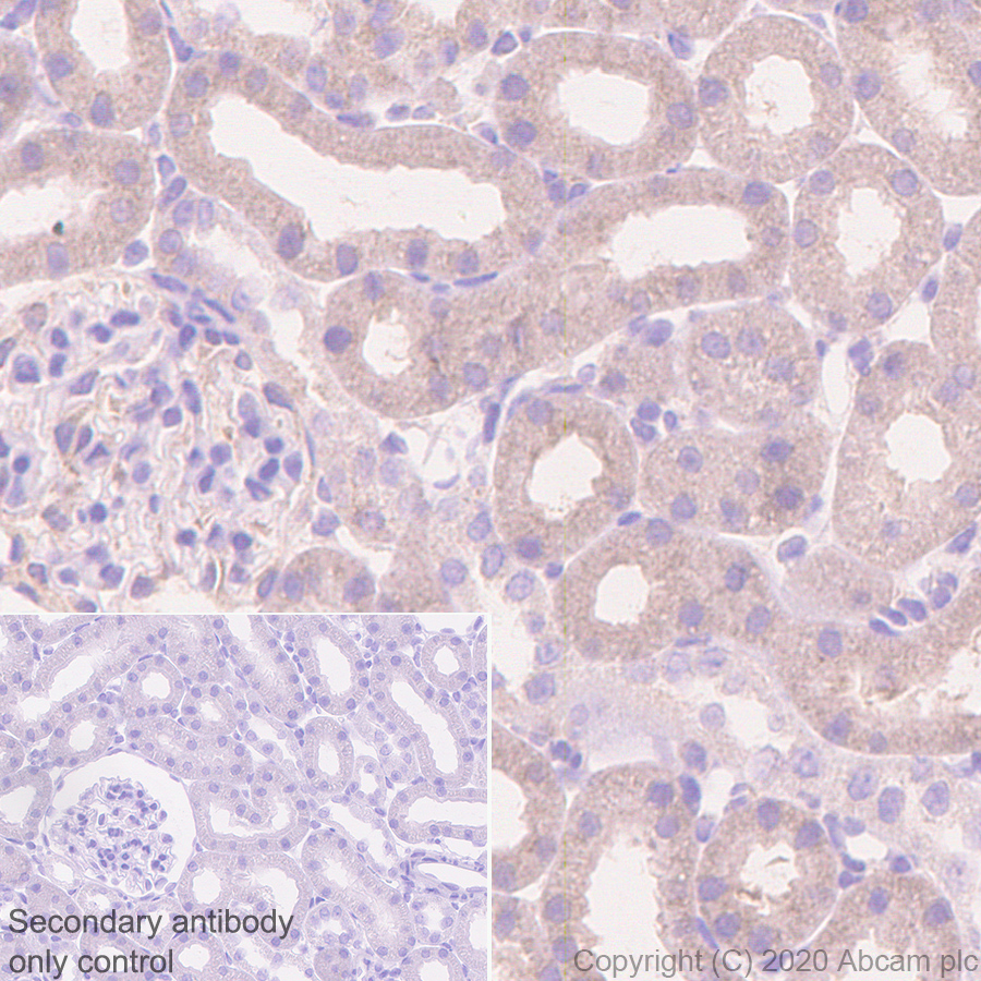 Immunohistochemistry (Formalin/PFA-fixed paraffin-embedded sections) - Anti-CCT2 antibody [EPR4084] - BSA and Azide free (AB247598), expandable thumbnail