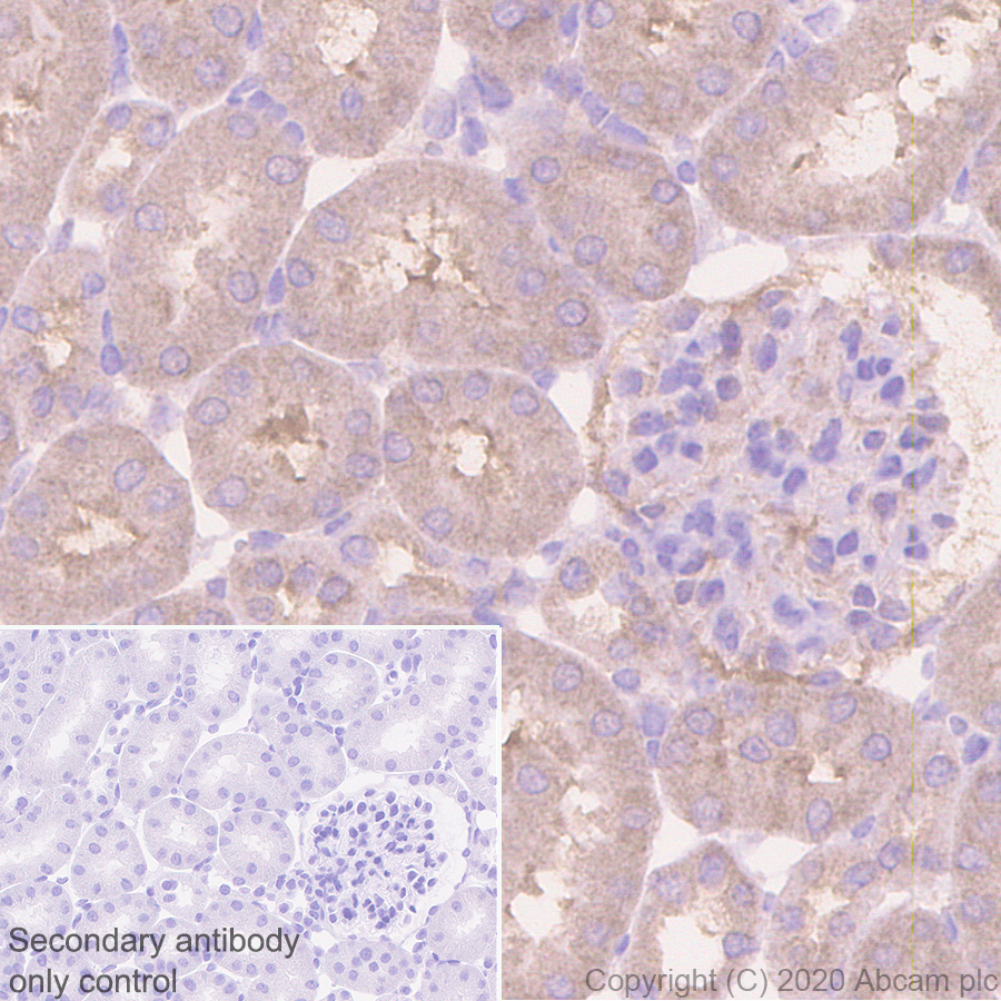 Immunohistochemistry (Formalin/PFA-fixed paraffin-embedded sections) - Anti-CCT2 antibody [EPR4084] - BSA and Azide free (ab247598), expandable thumbnail