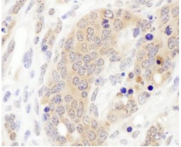 Immunohistochemistry (Formalin/PFA-fixed paraffin-embedded sections) - Anti-CCT3 antibody (AB176686), expandable thumbnail